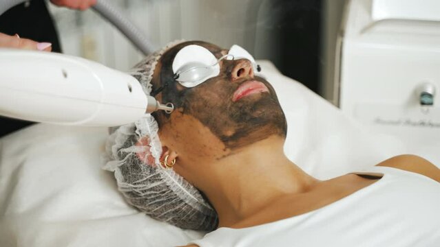SPA and aesthetic medicine concept. Unrecognizable aesthetician in black uniform using professional laser for discoloration treatment. Blurred background. High quality 4k footage