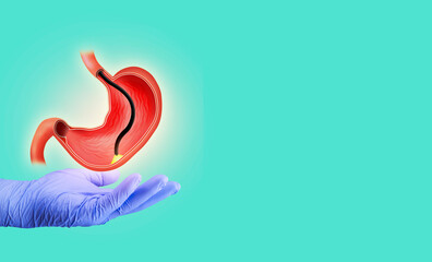 Endoscopic biopsy, esophagogastroduodenoscopy, EGD. Human stomach isolated on light green...
