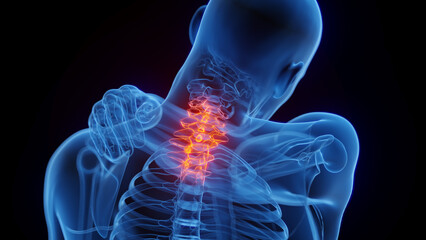 3D medical illustration of a man having neck pain