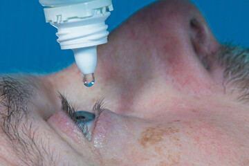 Eye drops being administered to a patient, with a close up view. Selective focus on the droplet of...