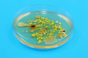 Germs on hands. Concept of hand hygiene