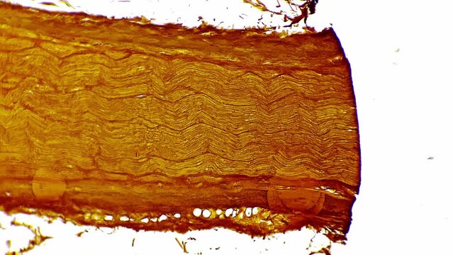 Silvering pattern of human nerves trunk in longitudinal section under microscope 100x on bright field. Isolated macro footage of fibers bundle of people nervous system. Studying neurology in lab
