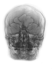 human skull anatomy