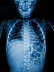 film x-ray show body of child