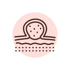 Pyogenic granuloma black line icon. Dermatology disease.