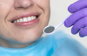 woman at dentist smiling open mouth doctor looking with mirror isolated blue textile bib.natural teeth beautiful girl smile no veneer.caries tartar in teeth back whitening scaling purple gloves