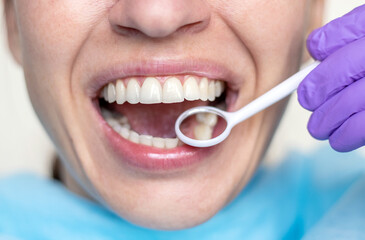 woman at dentist smiling open mouth doctor looking with mirror isolated blue textile bib.natural teeth beautiful girl smile no veneer.caries tartar in teeth back whitening scaling purple gloves