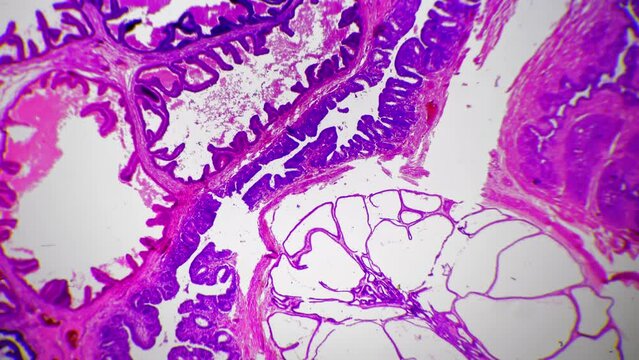 Microscopic magnification 100x of human prostate gland in section against bright field. Sample of male reproductive organ tissue filmed for educational issues. Research of male genitals. Man health