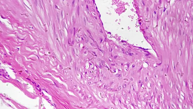 Human mammary gland secretion stage magnified in 400 times under microscope on bright field. Isolated macro slide of female breast cells on lactation. Studying anatomy and woman milk producing organ