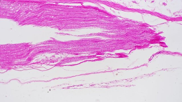 Nerves trunk of a human being in longitudinal section magnified with microscope 100x on bright field. Macro isolated view of people nervous system organ taken for studying its structure. Anatomy theme