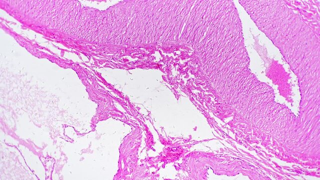 Human mammary gland secretion stage magnified in 200 times under microscope on white background. Isolated macro slide of female breast cells during lactation. Learning human milk producing organ
