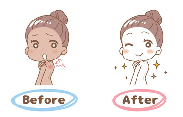 Set illustration of before and after sunburn, upper body.