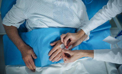Top view of nurse applying cannula at patients hand.