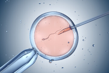 Artificial insemination or in vitro fertilization - obrazy, fototapety, plakaty