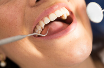 Close up hands of dentist in the gloves holding dental probe and intraoral mirror near woman teeth