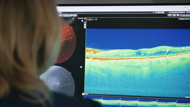 Ophthalmologist  doctor analyzing eye vision exams results, looking at monitor