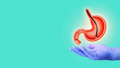 Endoscopic biopsy, esophagogastroduodenoscopy, EGD. Human stomach isolated on light green...