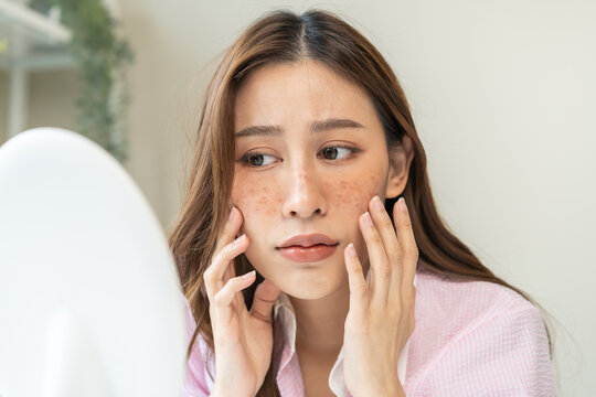Dermatology, expression face worry asian young woman looking mirror hand touch facial at dark spot of melasma, freckles from pigment melanin, allergy sun. Beauty care, skin problem treatment, skincare