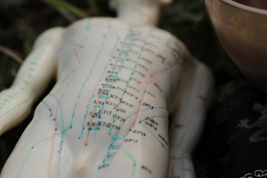 acupuncture