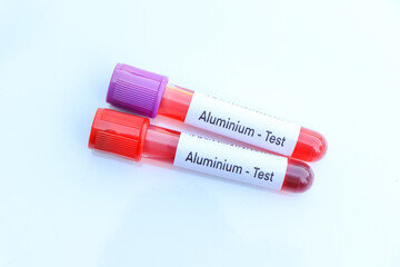 aluminium test to look for abnormalities from blood