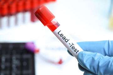 Fototapeta premium Lead test to look for abnormalities from blood