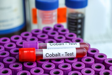 cobalt test to look for abnormalities from blood