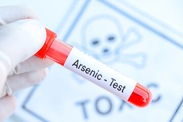Naklejka premium Arsenic test to look for abnormalities from blood
