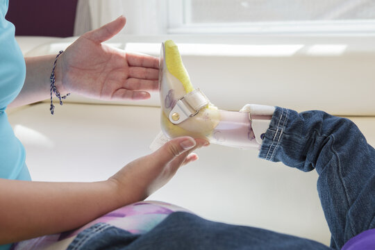 Mother putting leg brace on small daughter with Cerebral Palsy