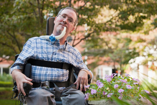 Man with Duchenne muscular dystrophy sitting in a wheelchair with a breathing ventilator