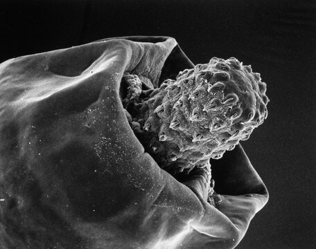 Microscopic view of a thorny-headed worm (Moniliformis moniliformis) magnified about 200 times.; EXACT LOCATION UNKNOWN.