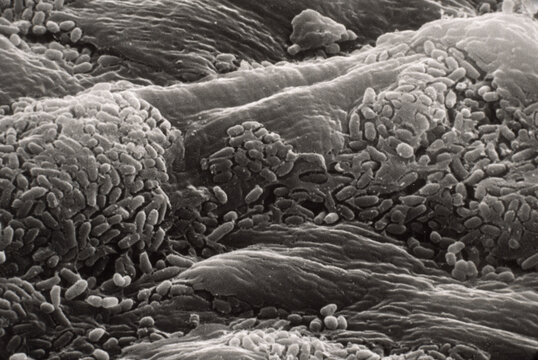 The underside of a person's toenail under high magnification, showing a landsca pe of rod-shaped bacteria.; U.S.A.