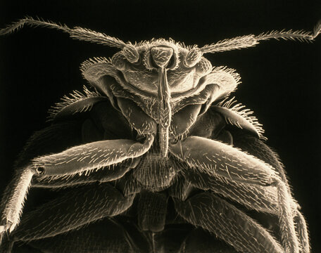 View of a common bedbug (Cimex lectularius) magnified 90 times normal size.; MASSACHUSETTS.