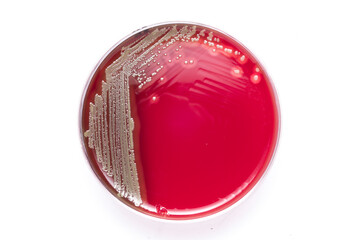 Burkholderia pseudomallei on gelose ram blood, inoculated by streaking metod, shows hemolisys