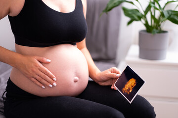 Unrecognizable pregnant woman sitting on bed caressing naked baby bump, belly, holding ultrasound...