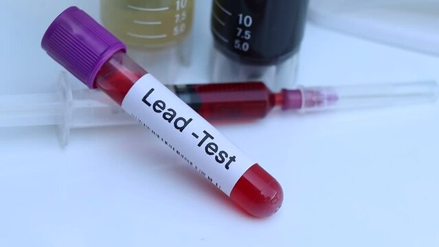 Lead test to look for abnormalities from blood,  blood sample to analyze in the laboratory
