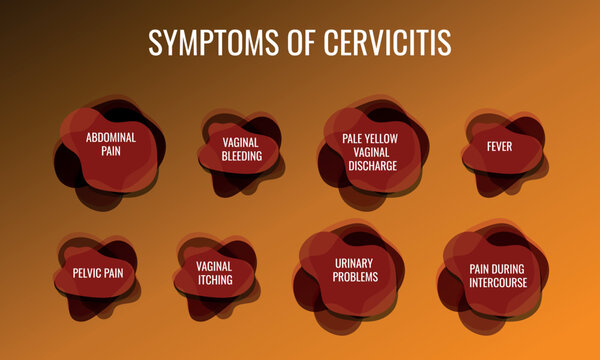 symptoms of Cervicitis. Vector illustration for medical journal or brochure.