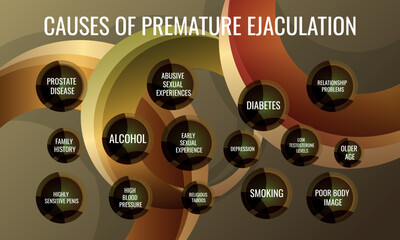 Causes of Premature Ejaculation. Vector illustration for medical journal or brochure.
