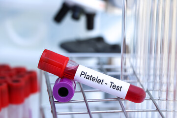 platelet test to look for abnormalities from blood
