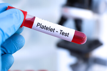 platelet test to look for abnormalities from blood