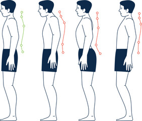 Male body with right and wrong spine postures. Body positions
