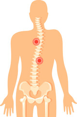 Backbone pain. Spine ache icon. Vertebral column diagram