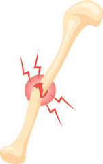 Fototapeta premium Broken bone icon. Cartoon medical fracture illustration