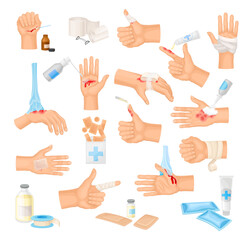 Hands with Injured Skin and Procedures of Bandaging and Wound Cleaning Big Vector Set