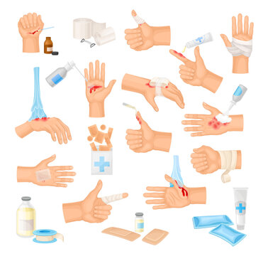 Hands with Injured Skin and Procedures of Bandaging and Wound Cleaning Big Vector Set