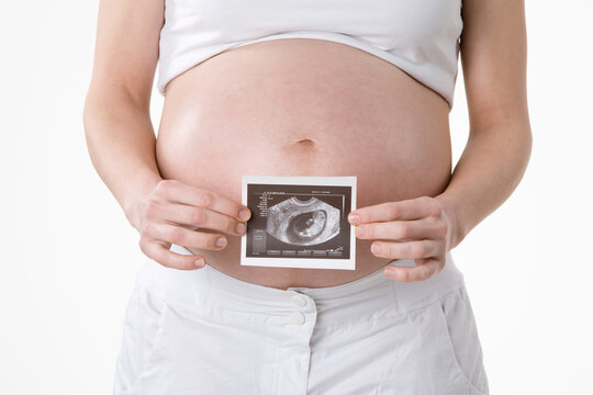 Pregnant Woman Holding Ultrasound Photograph
