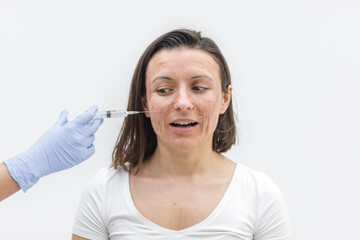 Naklejka premium Close up photo of woman with dry skin and hand in medical glove with injection.