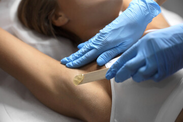 Young woman undergoing hair removal procedure of armpits with sugaring paste in salon, closeup