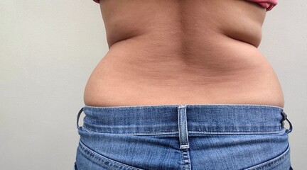 person in jeans Close-up view of the back and side of an Asian woman overweight&nbsp; shows excess fat&nbsp; and fissures occur and the concept of weight loss or liposuction