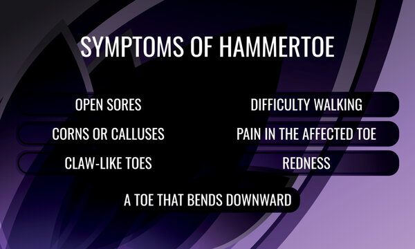 Symptoms of hammertoe. Vector illustration for medical journal or brochure.