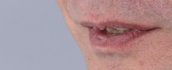 close up of unhealthy mouth
